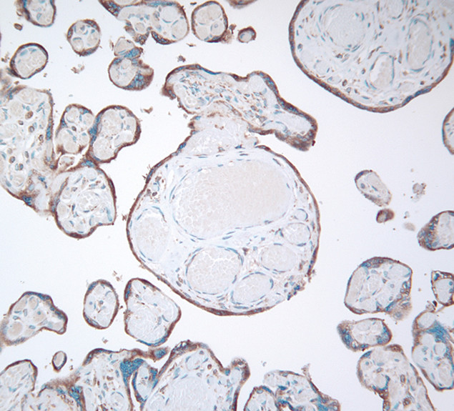 GRP94 Antibody in Immunohistochemistry (IHC)