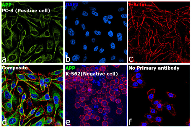 beta Amyloid Antibody