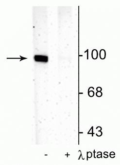 Phospho-GluR1 (Ser831) Antibody in Western Blot (WB)