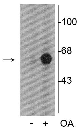 Phospho-Tyrosine Hydroxylase (Ser31) Antibody in Western Blot (WB)