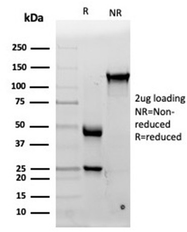 Interleukin-15 (IL-15) Antibody in SDS-PAGE (SDS-PAGE)