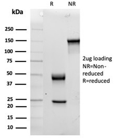 Interleukin-15 (IL-15) Antibody in SDS-PAGE (SDS-PAGE)