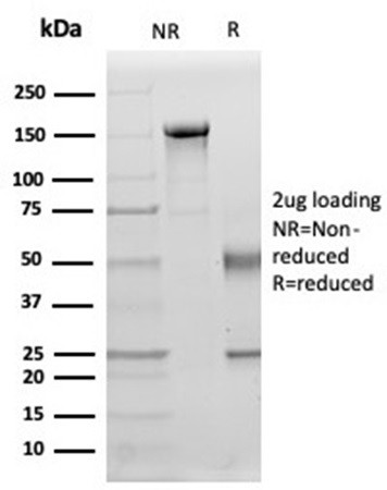 Interleukin-15 (IL-15) Antibody in SDS-PAGE (SDS-PAGE)