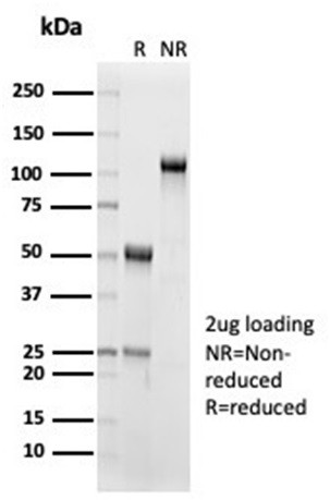 Interleukin-15 (IL-15) Antibody in SDS-PAGE (SDS-PAGE)