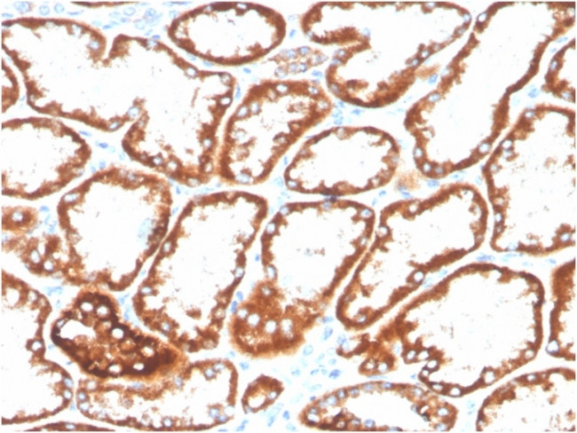 CD137/4-1BB/TNFRSF9 Antibody in Immunohistochemistry (Paraffin) (IHC (P))