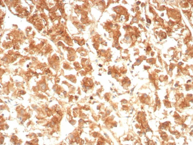 IL-18 (Interleukin-6)/Interferon beta-2 (Hybridoma Growth Factor) Antibody in Immunohistochemistry (Paraffin) (IHC (P))