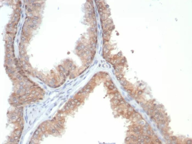 IL-18 (Interleukin-6)/Interferon beta-2 (Hybridoma Growth Factor) Antibody in Immunohistochemistry (Paraffin) (IHC (P))