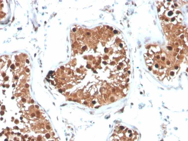 Inhibin, alpha (INHA) (Gonadal Cell Marker) Antibody in Immunohistochemistry (Paraffin) (IHC (P))