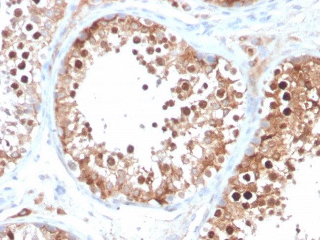 Inhibin, alpha (INHA) Antibody in Immunohistochemistry (Paraffin) (IHC (P))