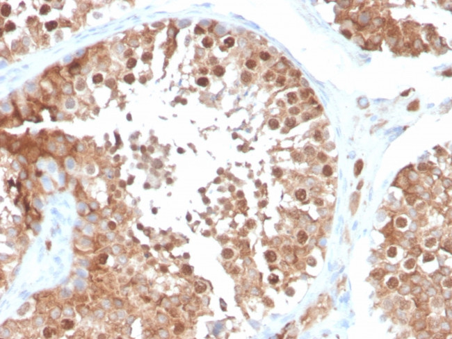 Inhibin, alpha (INHA) Antibody in Immunohistochemistry (Paraffin) (IHC (P))