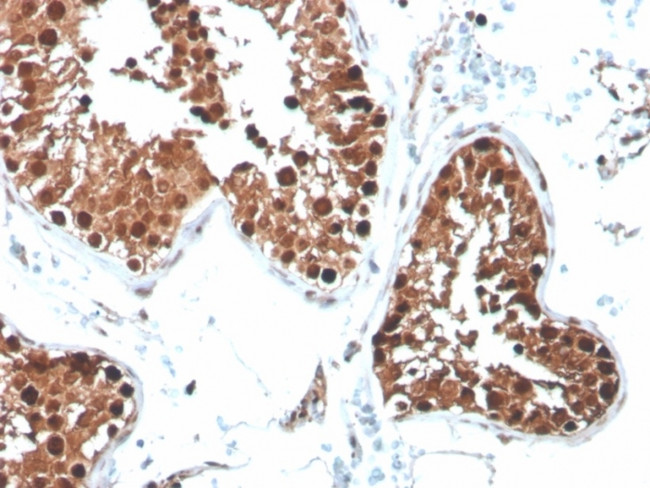 Inhibin, alpha (INHA) (Gonadal Cell Marker) Antibody in Immunohistochemistry (Paraffin) (IHC (P))