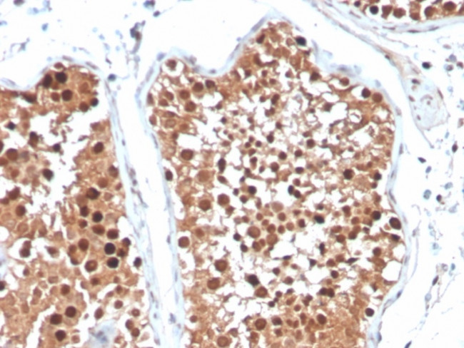 Inhibin, alpha (INHA) (Gonadal Cell Marker) Antibody in Immunohistochemistry (Paraffin) (IHC (P))