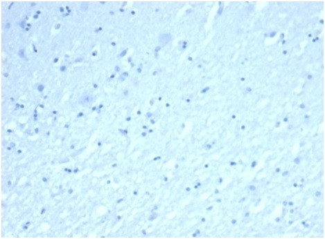 Inhibin, alpha (INHA) (Gonadal Cell Marker) Antibody in Immunohistochemistry (Paraffin) (IHC (P))