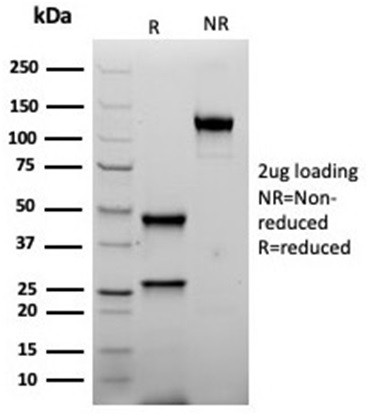 Inhibin, alpha (INHA) (Gonadal Cell Marker) Antibody in SDS-PAGE (SDS-PAGE)