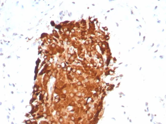 Inhibin, alpha (INHA) (Gonadal Cell Marker) Antibody in Immunohistochemistry (Paraffin) (IHC (P))