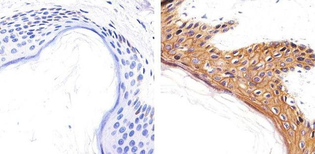 CD138 Antibody in Immunohistochemistry (Paraffin) (IHC (P))