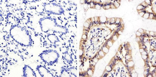 CD138 Antibody in Immunohistochemistry (Paraffin) (IHC (P))