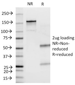 Insulin/IRDN (beta-Cell and Insulinoma Marker) Antibody in SDS-PAGE (SDS-PAGE)