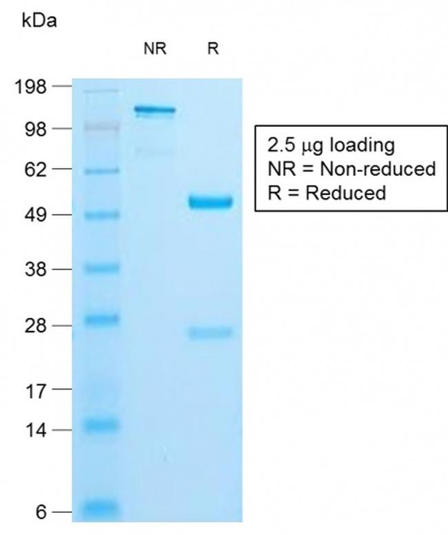 Insulin/IRDN Antibody in SDS-PAGE (SDS-PAGE)