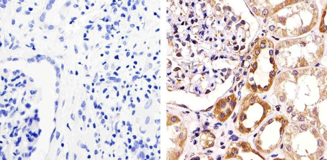 ZO-3 Antibody in Immunohistochemistry (Paraffin) (IHC (P))