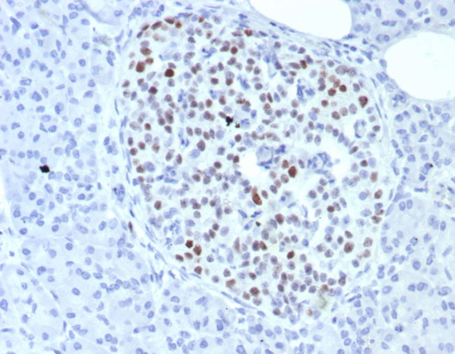 INSM1 (Pan-Neuroendocrine Marker) Antibody in Immunohistochemistry (Paraffin) (IHC (P))