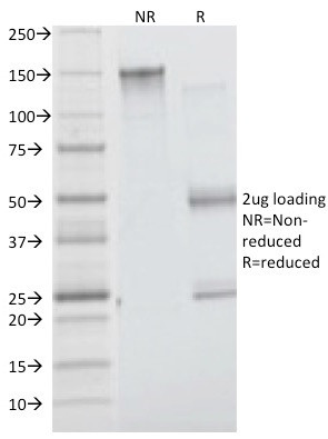 Insulin Receptor Alpha Antibody in SDS-PAGE (SDS-PAGE)