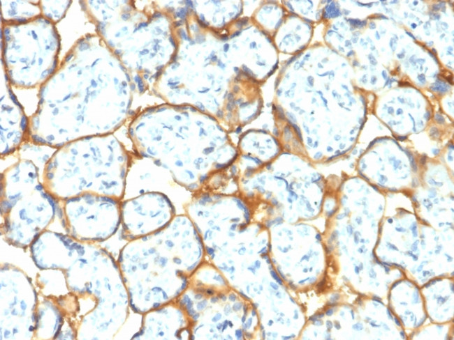 Insulin Receptor Alpha Antibody in Immunohistochemistry (Paraffin) (IHC (P))