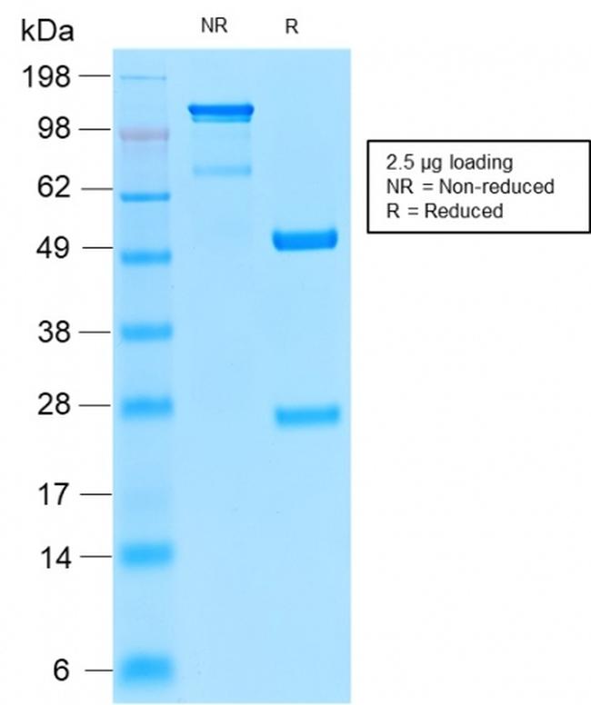 Insulin Receptor Alpha Antibody in SDS-PAGE (SDS-PAGE)