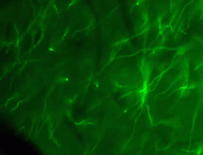 Claudin 11 Antibody in Immunohistochemistry (IHC)