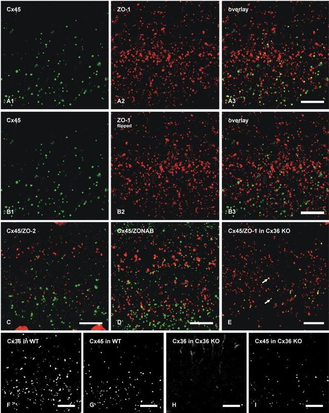 Connexin 36 Antibody in Immunohistochemistry (IHC)