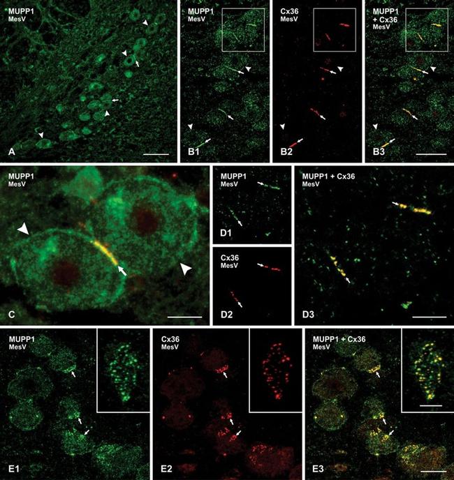 MUPP1 Antibody in Immunohistochemistry (IHC)