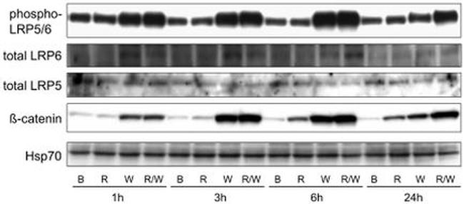 LRP5 Antibody in Western Blot (WB)