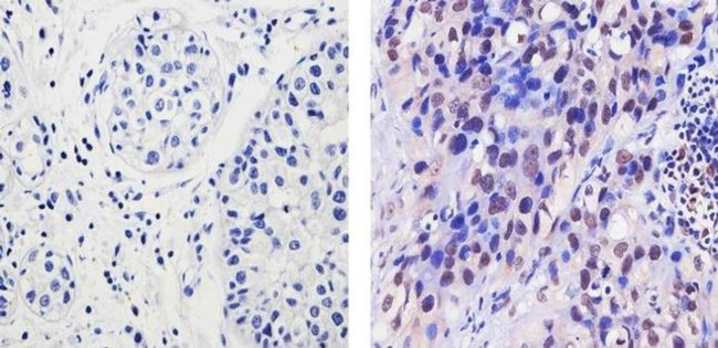 EZH2 Antibody in Immunohistochemistry (Paraffin) (IHC (P))