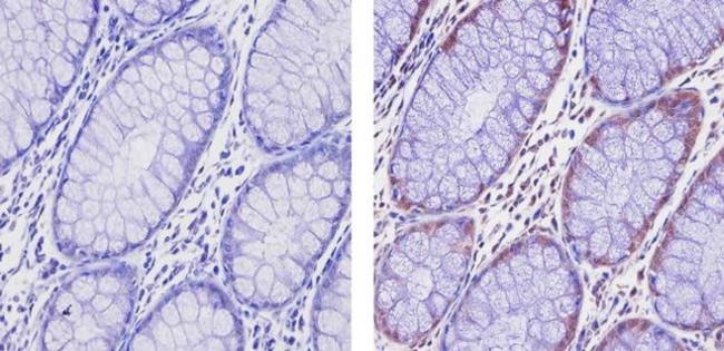 EZH2 Antibody in Immunohistochemistry (Paraffin) (IHC (P))