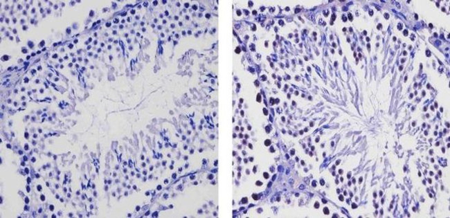 EZH2 Antibody in Immunohistochemistry (Paraffin) (IHC (P))