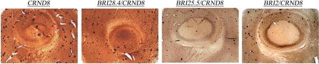 beta Amyloid Antibody in Immunohistochemistry (IHC)