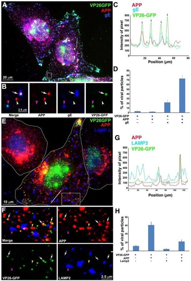 beta Amyloid Antibody in Immunocytochemistry (ICC/IF)