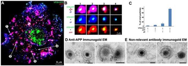 beta Amyloid Antibody in Immunocytochemistry (ICC/IF)