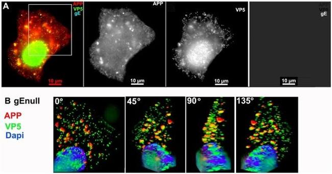 beta Amyloid Antibody in Immunocytochemistry (ICC/IF)