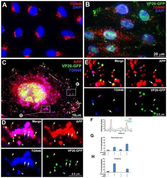 beta Amyloid Antibody in Immunocytochemistry (ICC/IF)