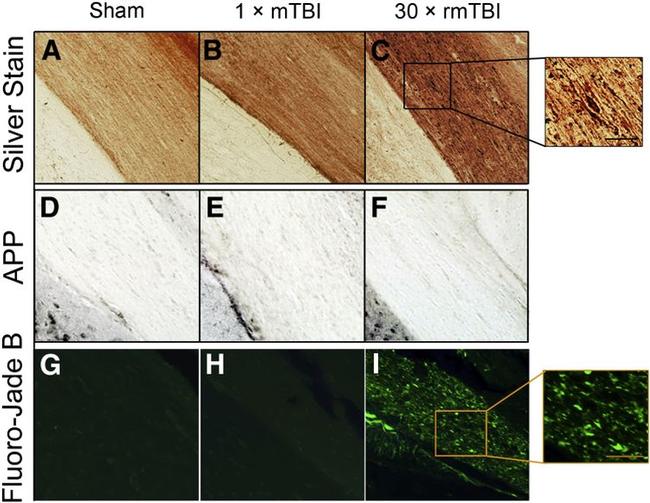 beta Amyloid Antibody in Immunohistochemistry - Free Floating (IHC (Free))