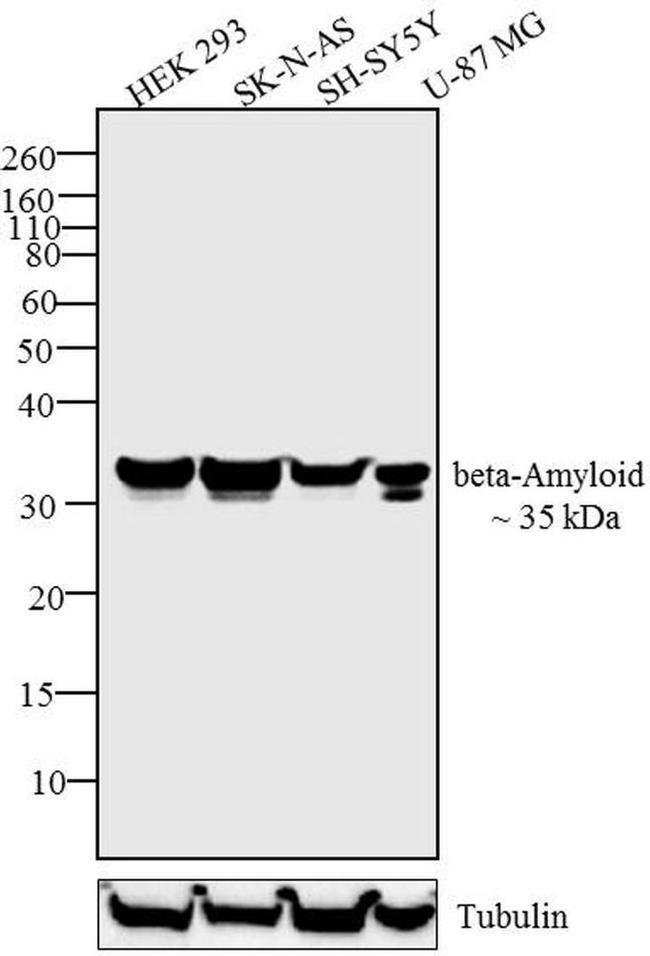 beta Amyloid Antibody in Western Blot (WB)