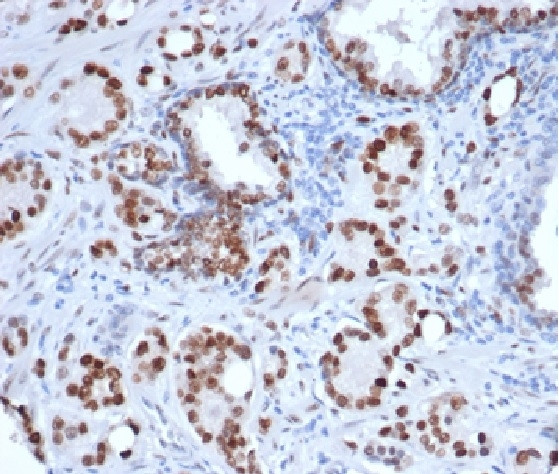 Androgen Receptor Antibody in Immunohistochemistry (Paraffin) (IHC (P))