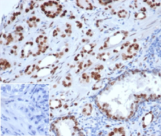 Androgen Receptor Antibody in Immunohistochemistry (Paraffin) (IHC (P))