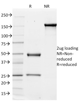 CD51/Integrin V Antibody in SDS-PAGE (SDS-PAGE)