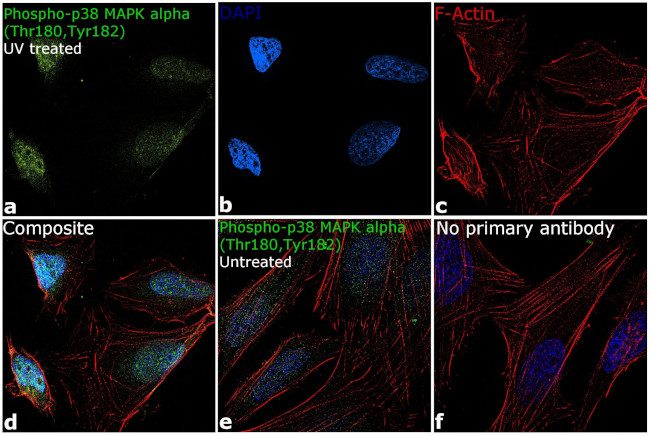 Phospho-p38 MAPK (Thr180, Tyr182) Antibody in Immunocytochemistry (ICC/IF)