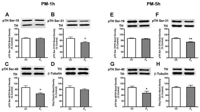 Phospho-Tyrosine Hydroxylase (Ser31) Antibody in Western Blot (WB)