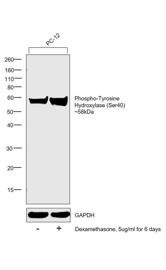 Phospho-Tyrosine Hydroxylase (Ser40) Antibody in Western Blot (WB)