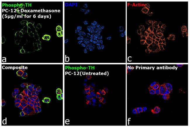 Phospho-Tyrosine Hydroxylase (Ser40) Antibody