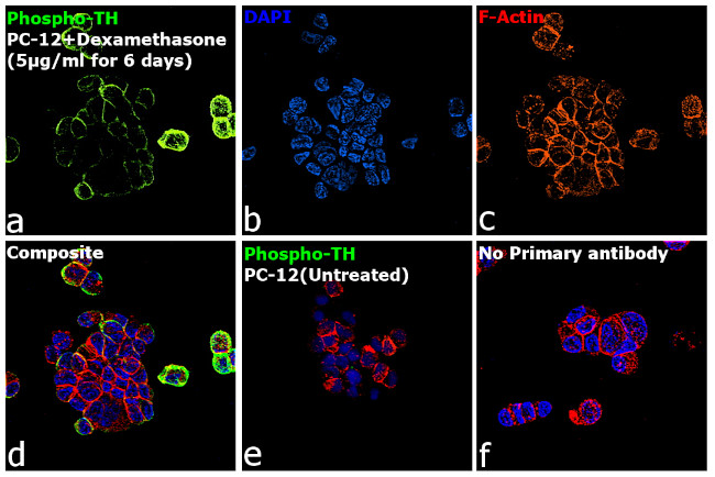 Phospho-Tyrosine Hydroxylase (Ser40) Antibody in Immunocytochemistry (ICC/IF)